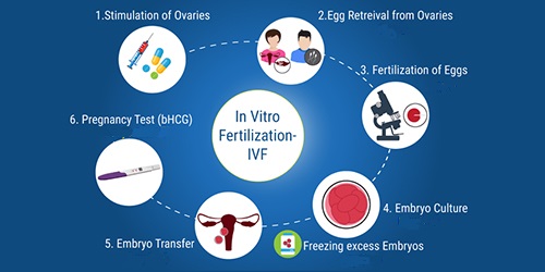 vitro-fertilization